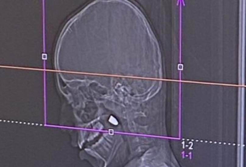 تصوير قسم الناطق بلسان رمبام